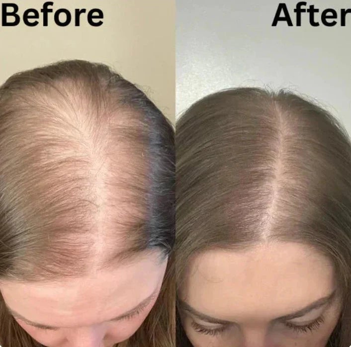 Organic Rosemary Hair Growth Shampoo